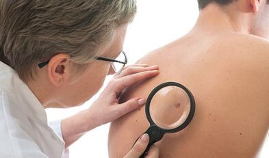 Virus človeškega papiloma pri moških