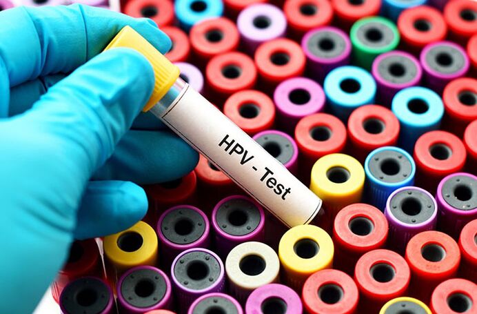 Krvni test za humani papiloma virus